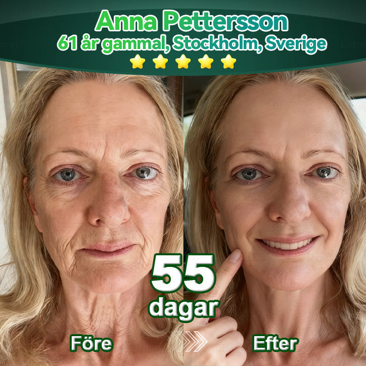 𝐂𝐫𝐨𝐚𝐢𝐞® 🚀 Stamcells & kollagenpeptid Orala Droppar(Lyft och strama upp slapp hud, minska rynkbildning och främja hårväxt och nagelhälsa)