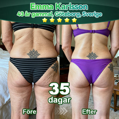 𝐂𝐫𝐨𝐚𝐢𝐞® 🚀 Stamcells & kollagenpeptid Orala Droppar(Lyft och strama upp slapp hud, minska rynkbildning och främja hårväxt och nagelhälsa)